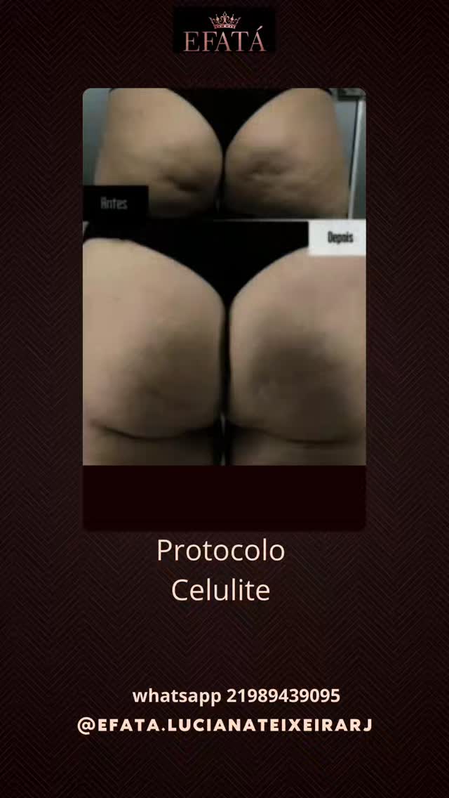 Protocolo Celulite: registro publicado pela Efatá