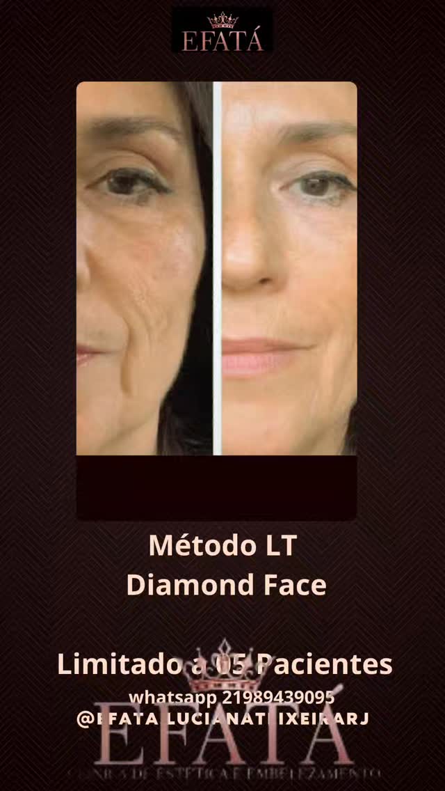 LT Diamond Face: registro publicado pela Efatá